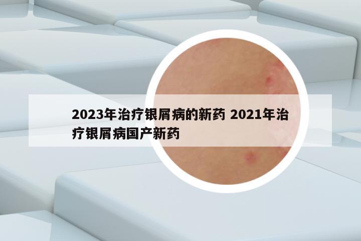 2023年治疗银屑病的新药 2021年治疗银屑病国产新药