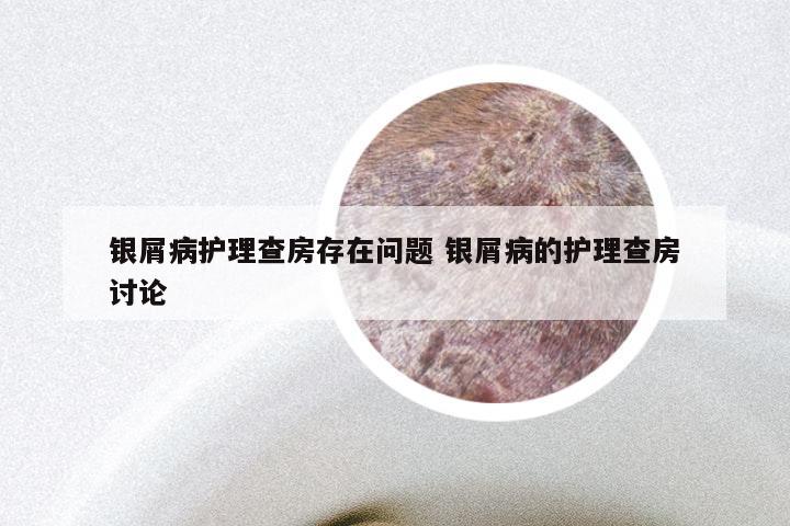 银屑病护理查房存在问题 银屑病的护理查房讨论